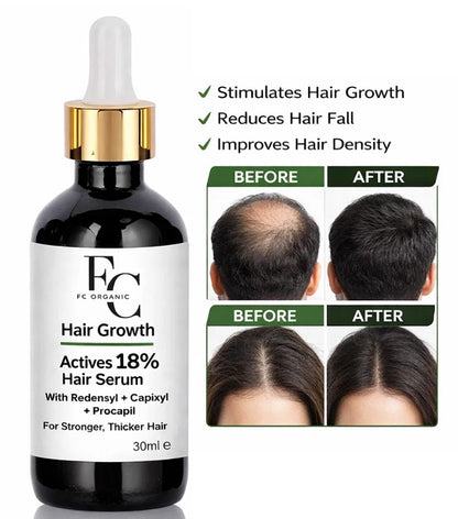 Herbal Hair Growth Serum 30ml | Rosemary & Onion Water-Based Formula