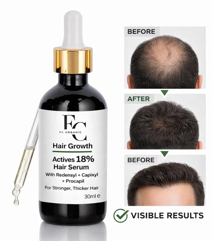 Herbal Hair Growth Serum 30ml | Rosemary & Onion Water-Based Formula