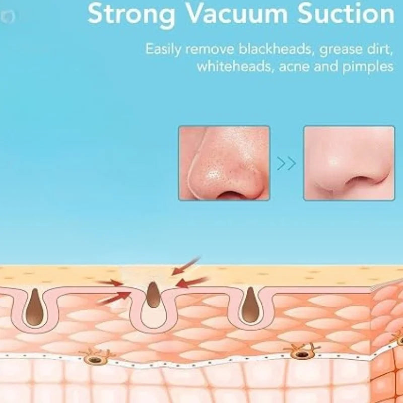 Rechargeable Blackhead Remover Vacuum Cleaner | Model FPLS-001 | Deep Pore Cleansing & Microdermabrasion Device