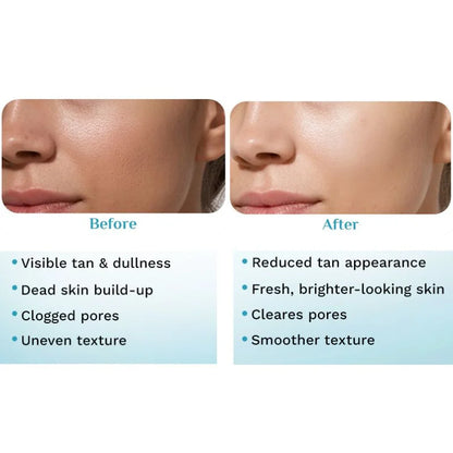 Pilgrim Peeling Solution | Weekend Facial Peel for Deep Cleansing & Exfoliation | Radiant & Even-Toned Skin | For Men & Women | 30ml